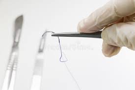 Suture removal and procedure kit contents